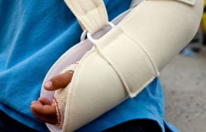 bigstockphoto_Broken_Arm_300X193